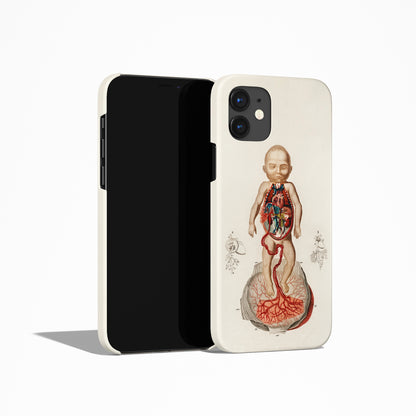 Psychodelic Kid iPhone Case